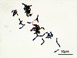 Bifidobacterium adolescentis Gram.jpg