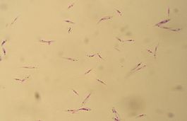 Promastigotes of Leishmania tropica.jpg
